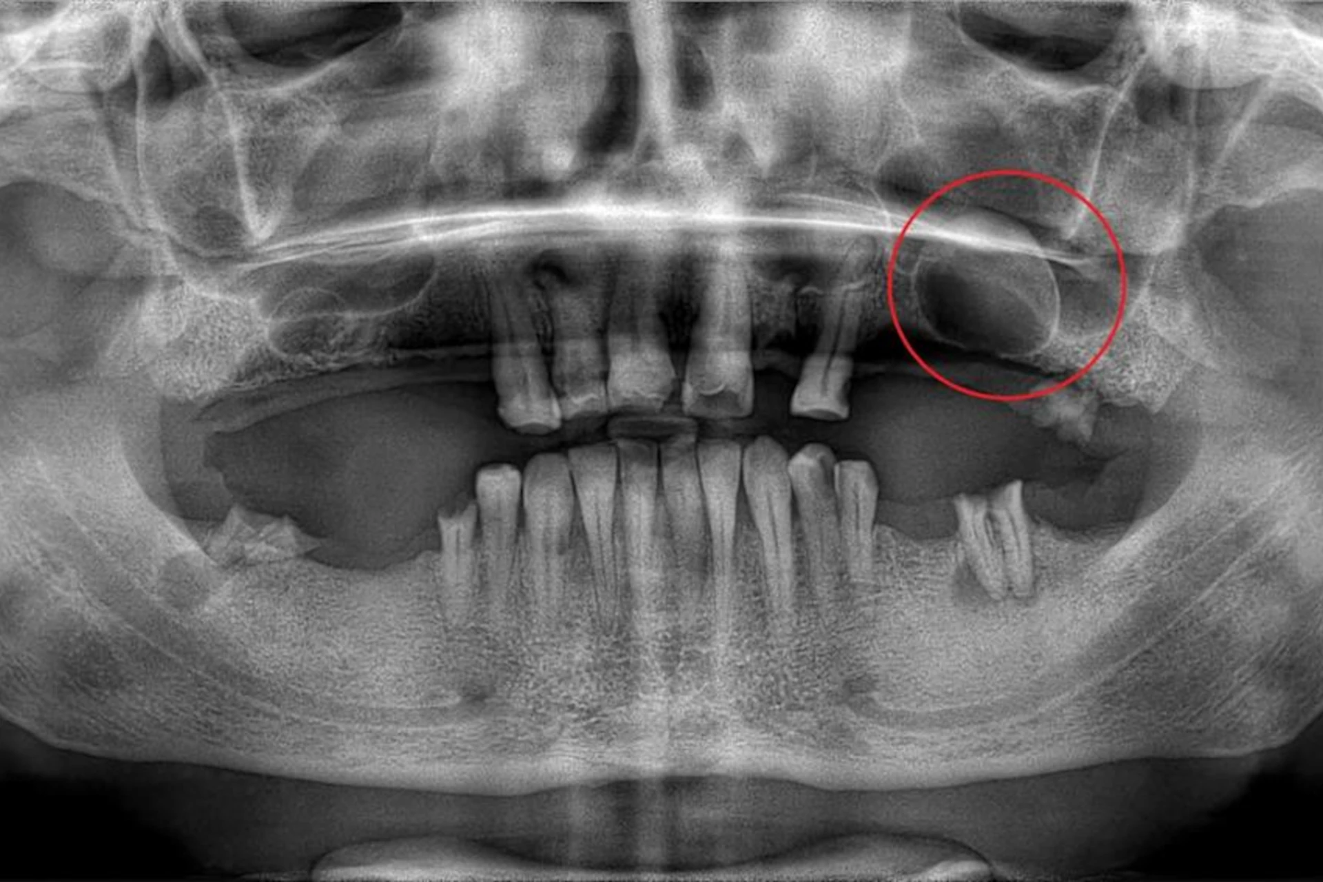 https://dinamikdis.com/en/wp-content/uploads/sites/2/2024/08/tooth-tumor-operations-1.webp