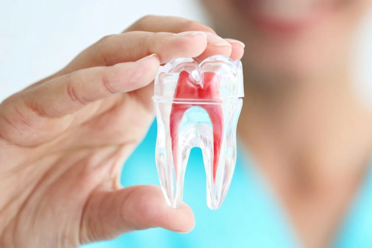 Endodonti (Kanal) Tedavileri